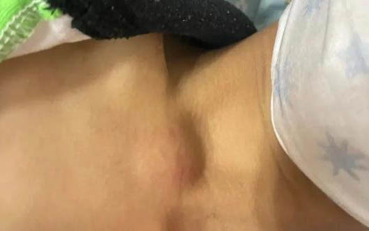 狗狗吃撑了肚子特别大怎么办